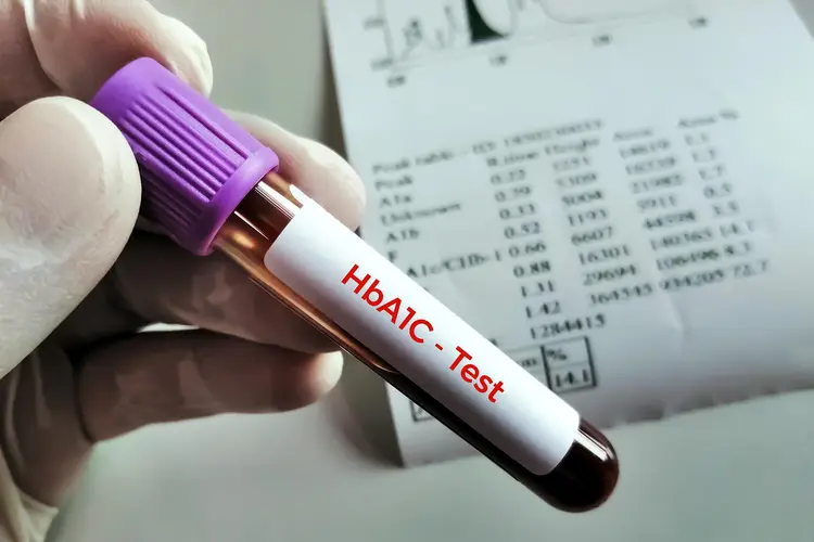 HbA1c 7 కంటే తక్కువగా ఉందా? అయినా షుగర్‌ కంట్రోల్‌లో లేకపోవచ్చు!